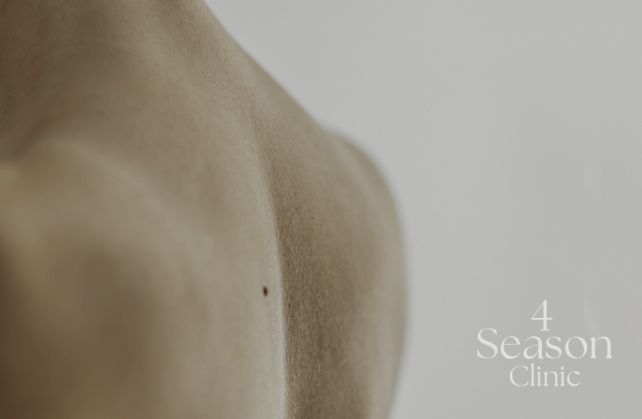 포시즌의원 등/가슴 여드름 치료 제스너필